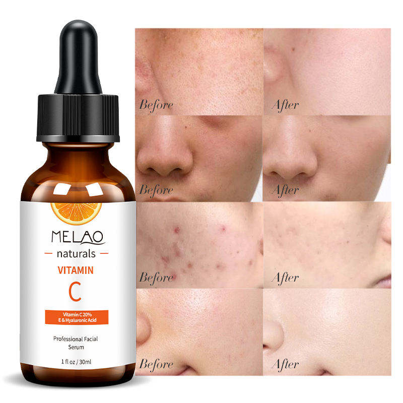 Melao Hyaluronic Acid & Vitamin C Serum – Korean Anti-Aging Whitening Face Care with Peptides Moisturizer