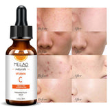 Melao Hyaluronic Acid & Vitamin C Serum – Korean Anti-Aging Whitening Face Care with Peptides Moisturizer